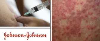 J&J logo, syringe and rashes